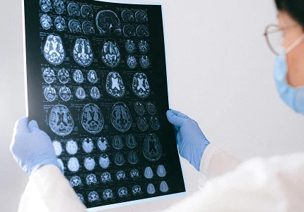 Promjene u mozgu do kojih dolazi kada se ne unosi dovoljno proteina