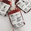 Baraninu Sretu Boškoviću hitno potrebni krv i trombociti