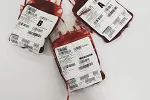 Baraninu Sretu Boškoviću hitno potrebni krv i trombociti