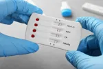 Veliki korak u borbi protiv HIV-a: Novi materijal ruskih naučnika smanjio virus 100.000 puta