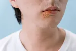 Virus herpesa može da poremeti odbrambeni sistem mozga, pokazuje novo istraživanje