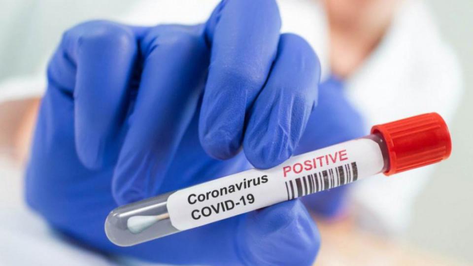 U Hrvatskoj na tržištu se pojavili kućni koronavirus testovi, cijene do 115 eura | Radio Televizija Budva