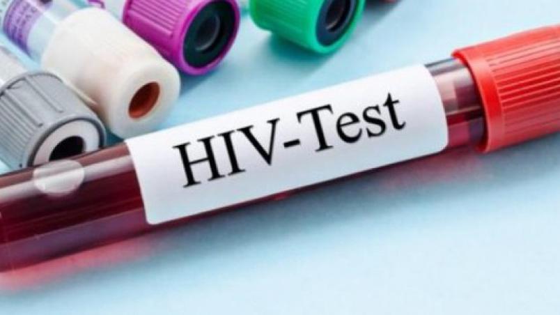 Na terapiji 181 osoba zaražena HIV-om | Radio Televizija Budva