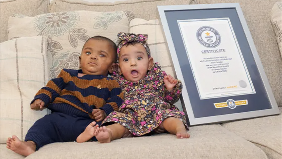 Kanada i porodica: Najraniji prijeevremeno rođeni blizanci, doktori nijessu vjerovali da će preživjeti | Radio Televizija Budva